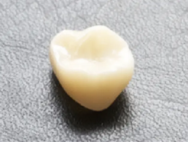 セラミックのかぶせ物