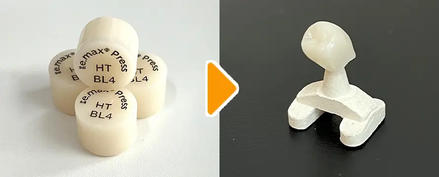 e-maxでできたセラミック歯