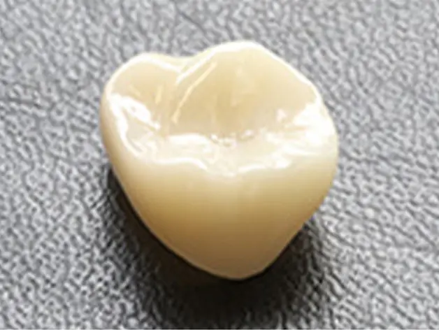 フルジルコニア・クラウン・エステティック