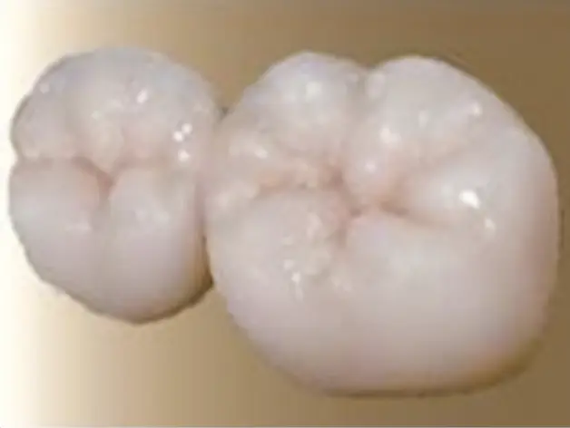 ジルコニア・ボンド