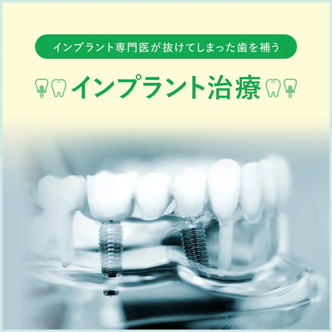 インプラント専門医が抜けてしまった歯を補う　インプラント治療