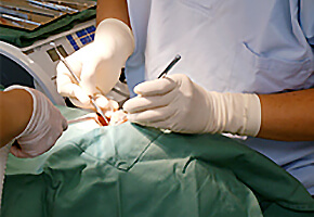 南茨木プラザ歯科の虫歯治療　歯周外科治療